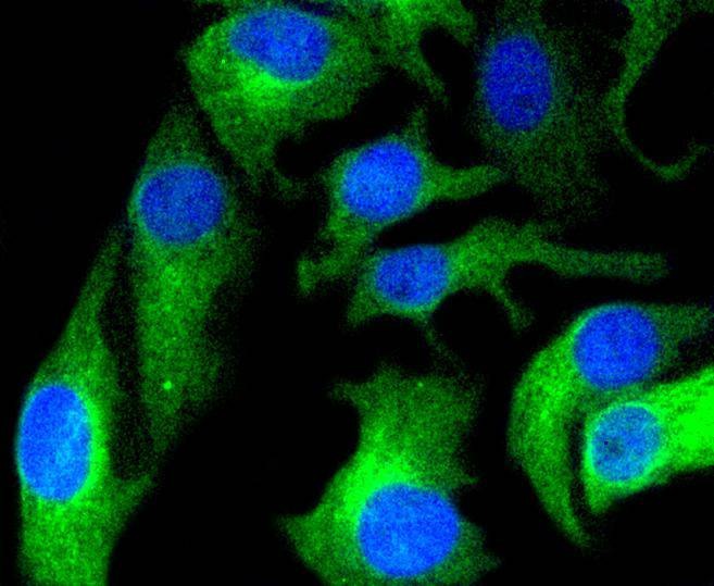 Anti-HAPLN1 Antibody (1R32)