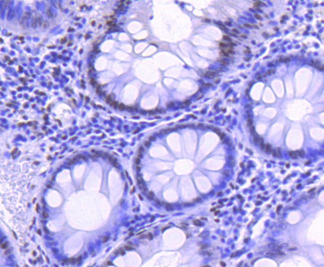 Anti-Acetyl-Histone H2B type 1-K (Lys20) Antibody (5U443)