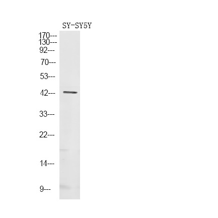 Anti-Phospho-GNAZ (Ser16) Polyclonal Antibody