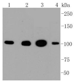 Anti-HK1 Antibody (7G677)