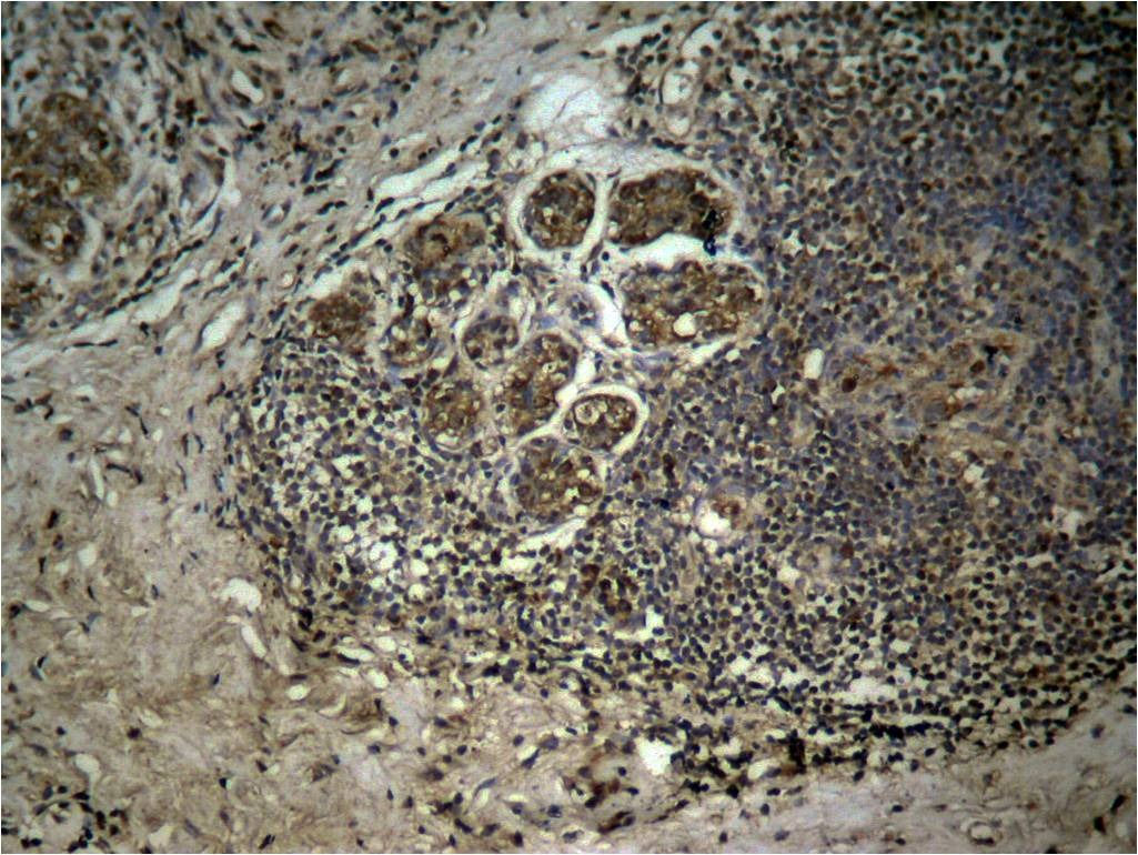 Anti-Tri-methyl-HIST1H3A (Lys27) Polyclonal Antibody