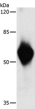 Anti-HA Tag Polyclonal Antibody 2