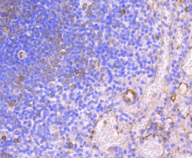 Anti-HAPLN1 Antibody (1R32)