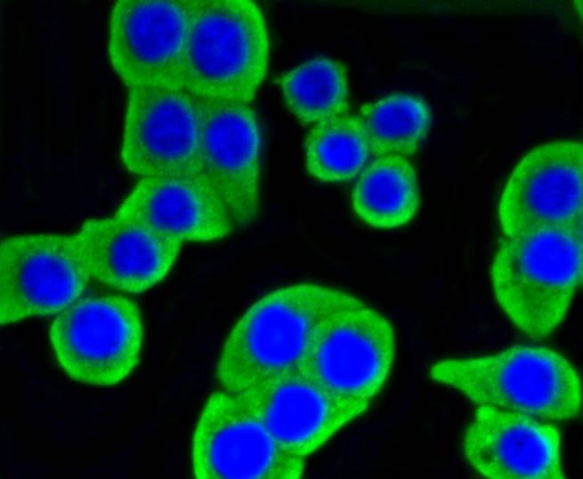 Anti-HK1 Antibody (7G677)