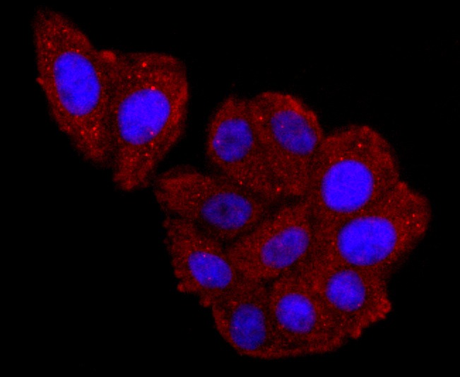Anti-Haptoglobin Antibody (8N175)