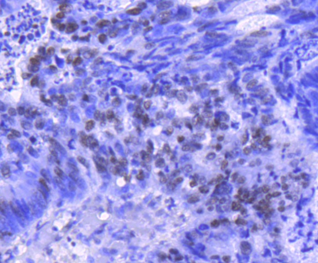 Anti-Acetyl-Histone H2B type 1-K (Lys20) Antibody (5U443)