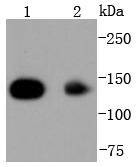 Anti-HDAC4 Antibody (5T743)