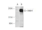 Anti-HER4/ERBB4 Antibody (8W756)