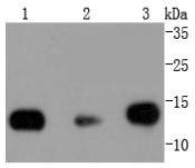 Anti-Histone H2B type 1-K Antibody (4Z139)