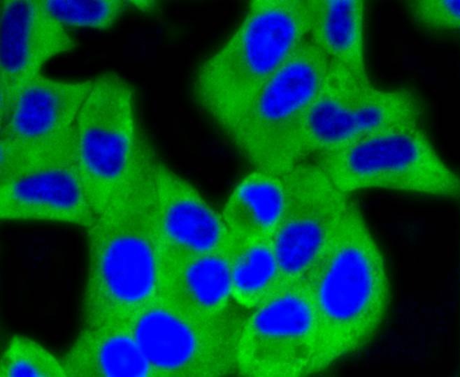Anti-HK1 Antibody (7G677)