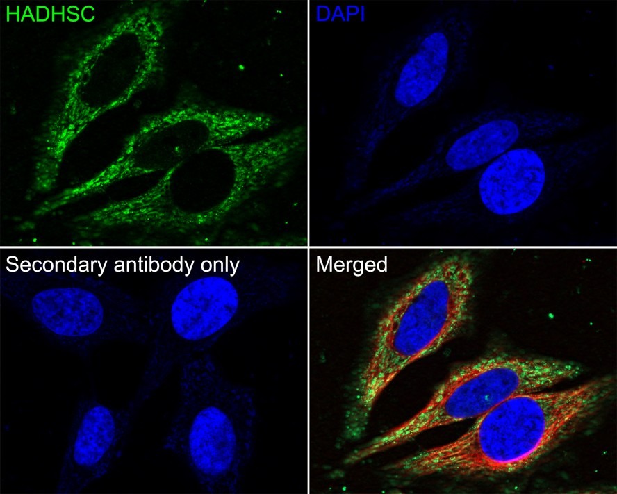 Anti-HADHSC Antibody (1K241)