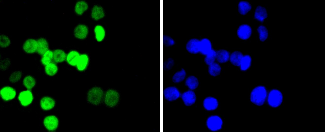 Anti-Acetyl-Histone H2B type 1-K (Lys20) Antibody (5U443)