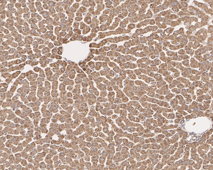 Anti-HADHSC Antibody (1K241)