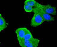 Anti-HDAC4 Antibody (5T743)