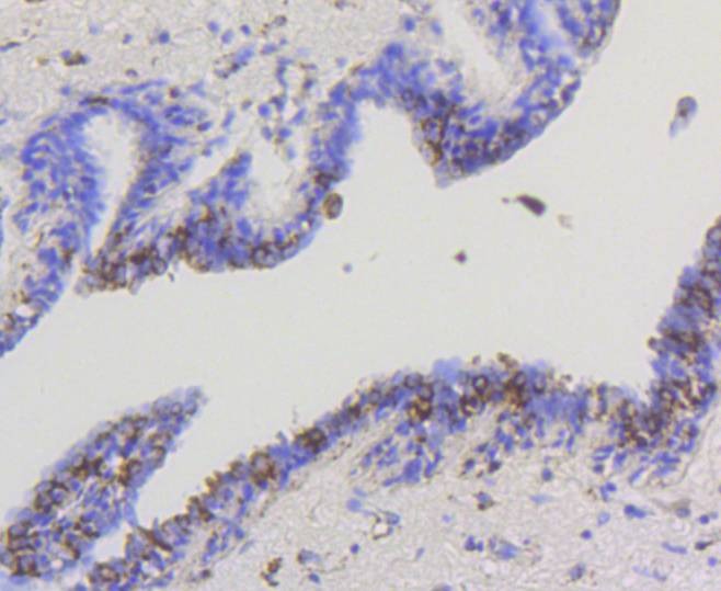 Anti-HK1 Antibody (7G677)