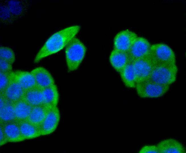 Anti-HAPLN1 Antibody (1R32)