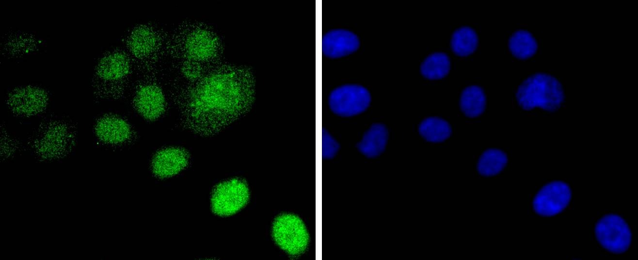 Anti-Mono-methyl-Histone H2B type 1-K (Arg79) Antibody (5Q957)