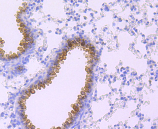 Anti-Haptoglobin Antibody (8N175)