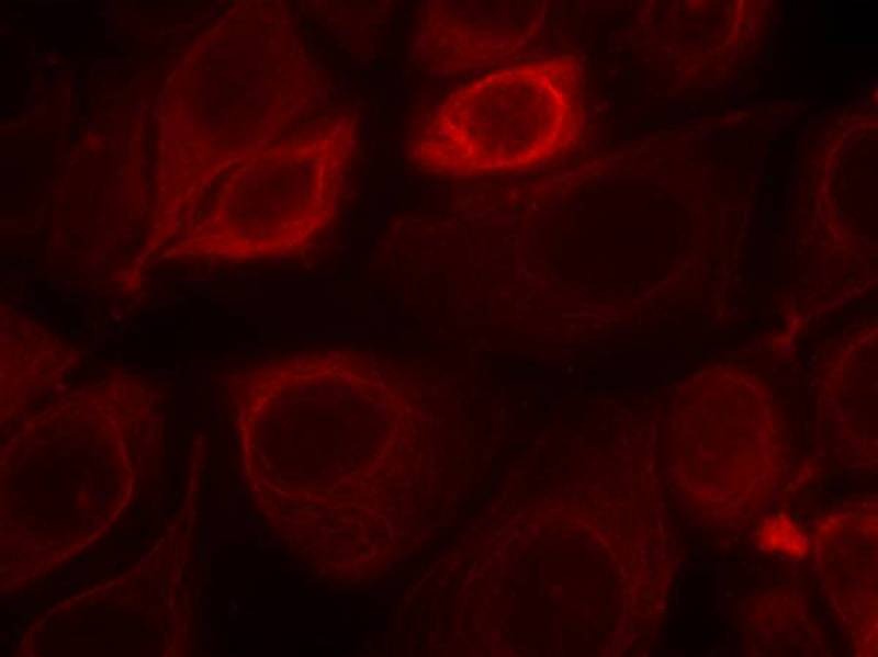 Anti-Phospho-HER3/ERBB3 (Tyr1328) Polyclonal Antibody