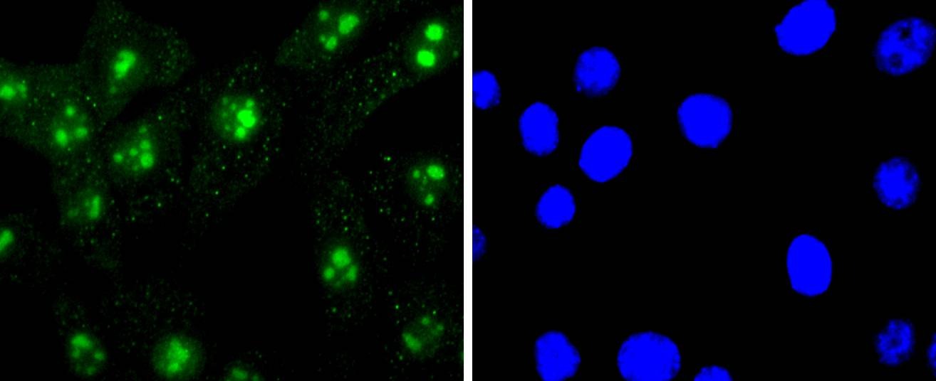 Anti-Mono-methyl-HIST1H3A (Arg2) Antibody (9C212)