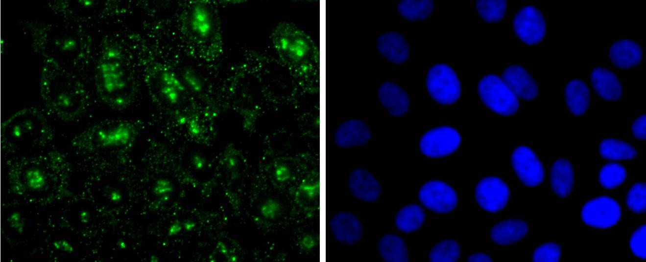 Anti-Mono-methyl-HIST1H3A (Arg2) Antibody (9C212)