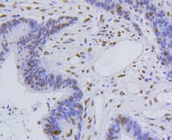 Anti-Acetyl-Histone H4 (Lys5) Antibody (9C227)