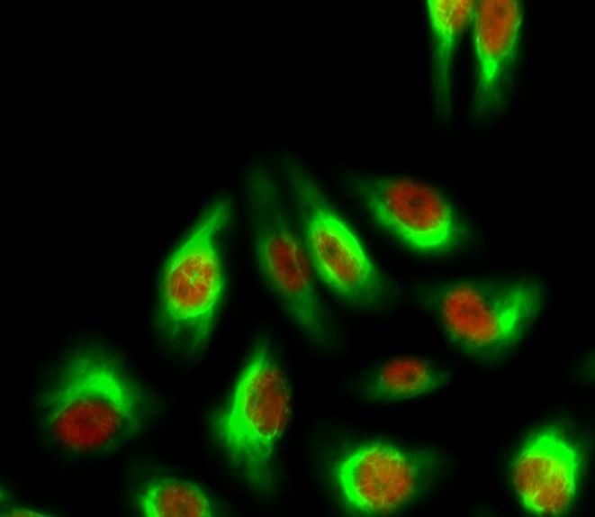 Anti-Acetyl-HIST1H3A (Lys27) Polyclonal Antibody