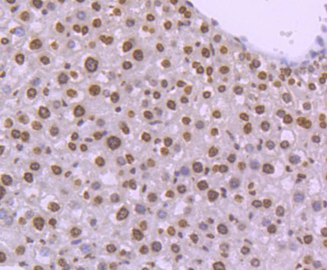 Anti-Tri-methyl-Histone H4 (Lys20) Antibody (5D958)
