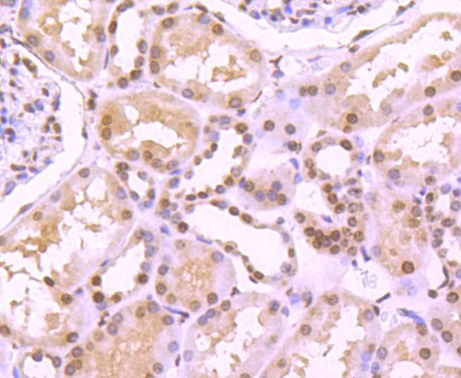 Anti-Tri-methyl-Histone H4 (Lys20) Antibody (5D958)