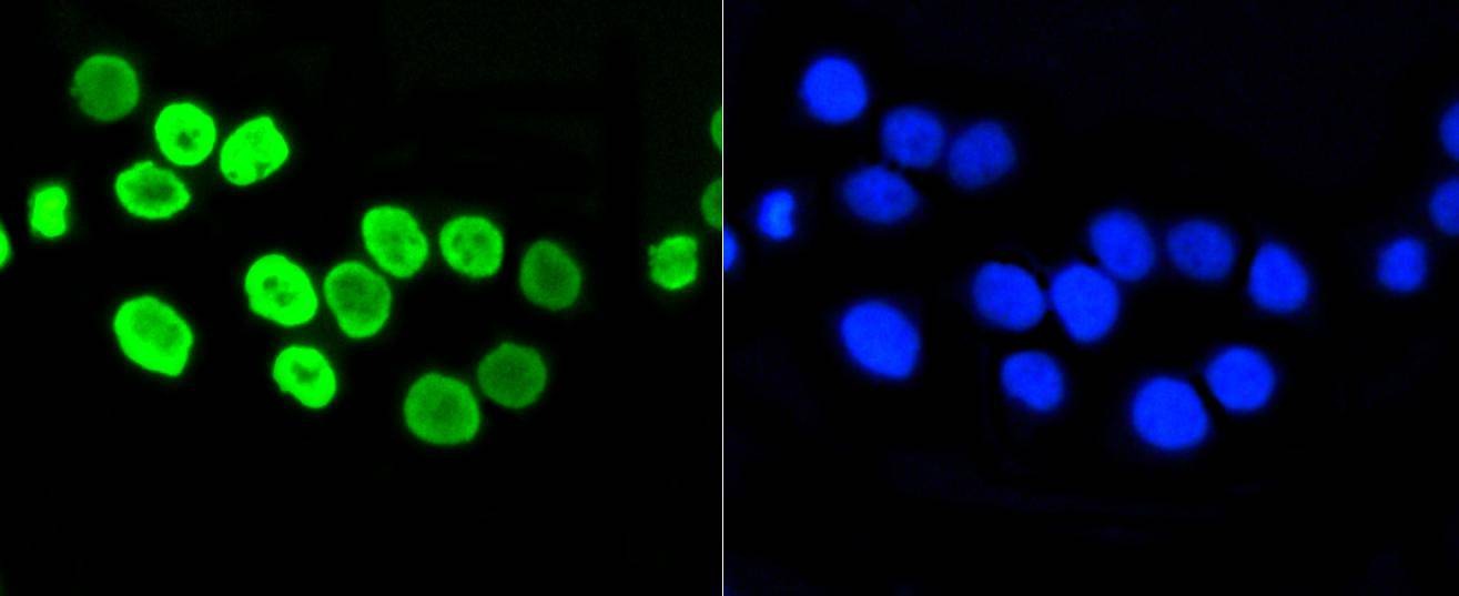 Anti-Acetyl-Histone H4 (Lys5) Antibody (9C227)