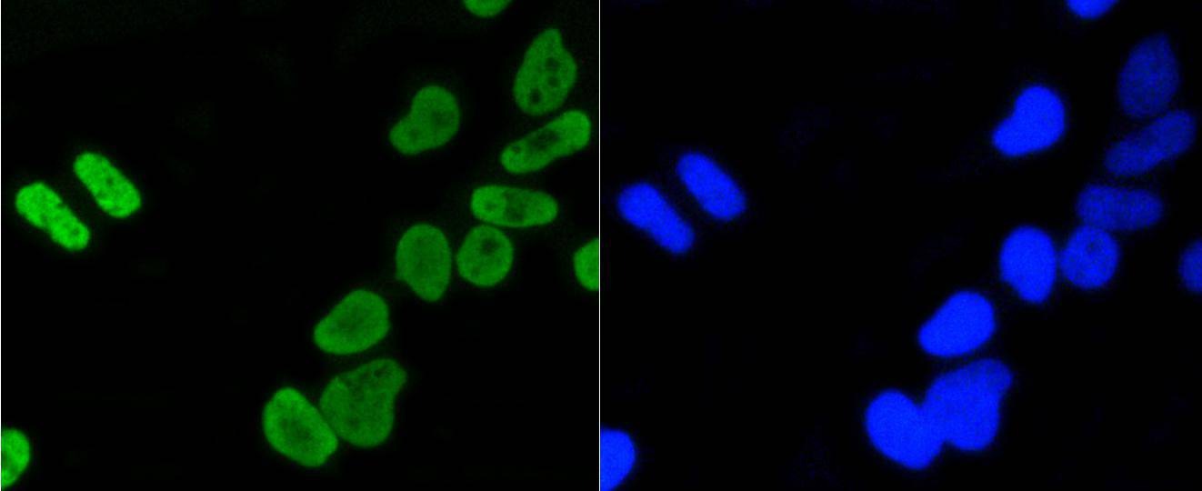 Anti-Acetyl-Histone H4 (Lys5) Antibody (9C227)
