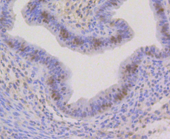 Anti-CBX5 Antibody (5G758)