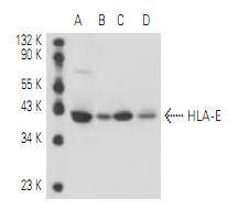 Anti-HLA-E Antibody (6I53)