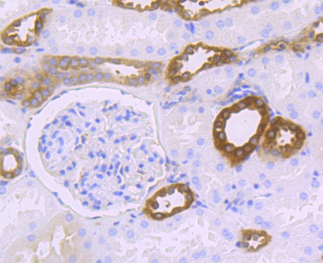 Anti-HGPRT Antibody (2V553)