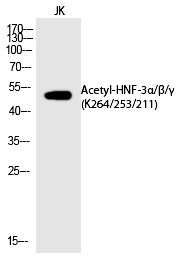 Anti-Acetyl-FOXA1/HNF-3β/γ (Lys264/253/211) Polyclonal Antibody