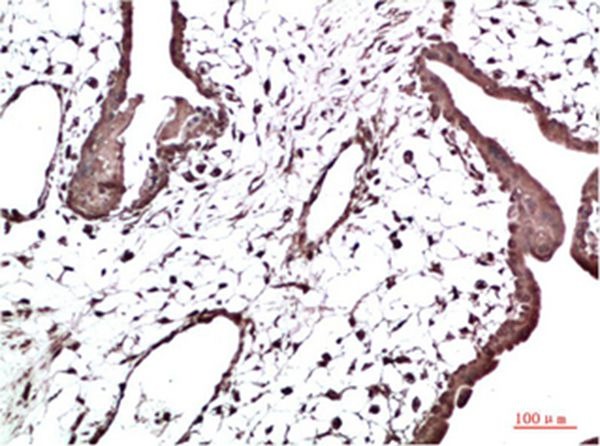 Anti-CBX3 Antibody (1M6)
