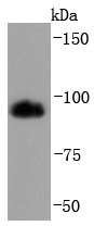 Anti-HMGCR Antibody (4H804)