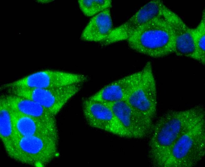 Anti-HSPB8 Antibody (1K143)
