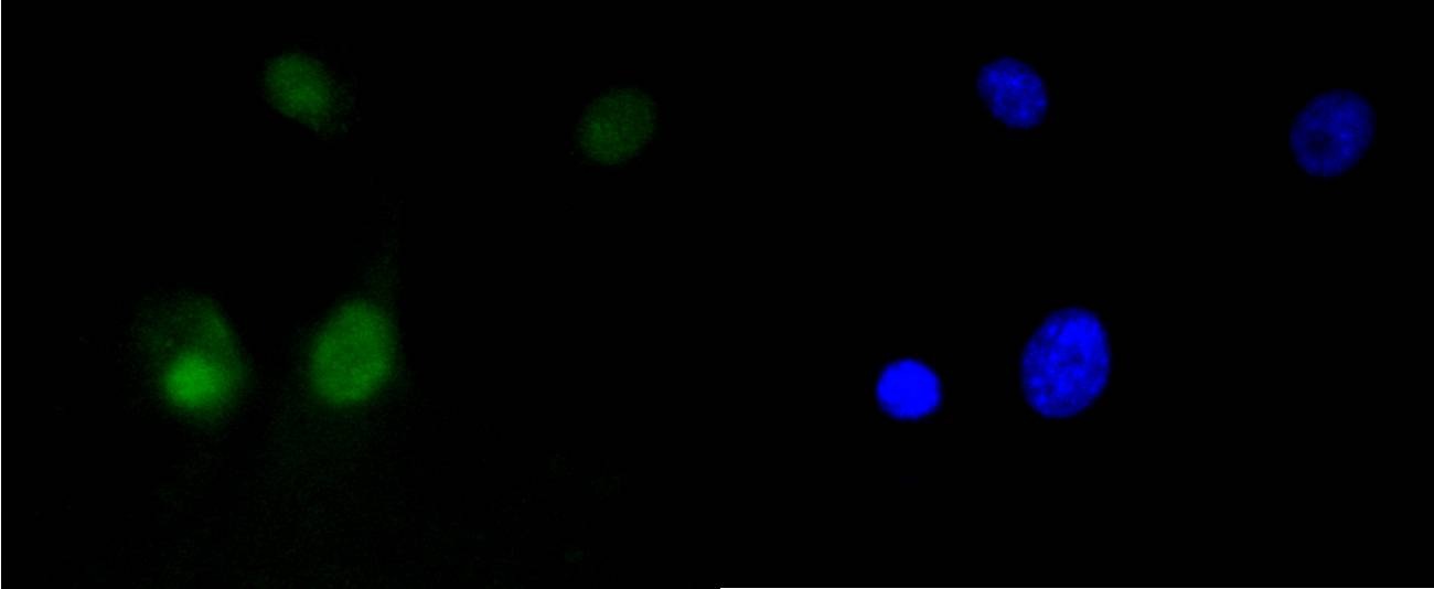 Anti-HMGB1 Antibody (5H227)