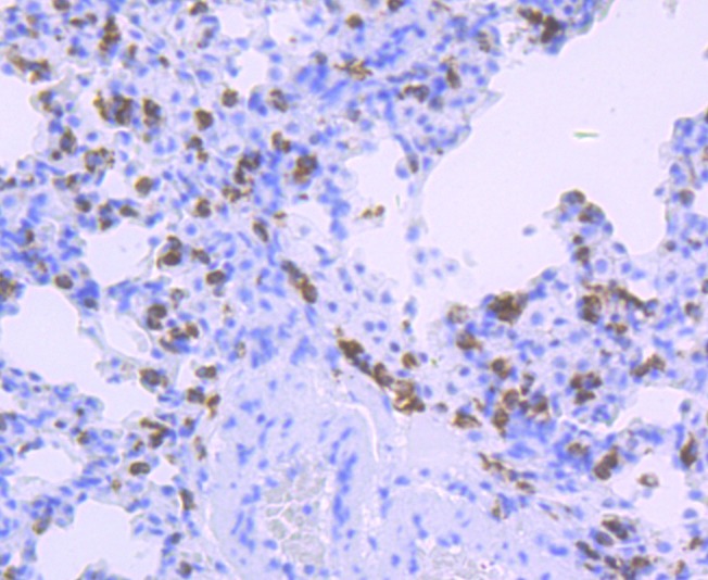 Anti-HLA-DQA1 Antibody (6J773)