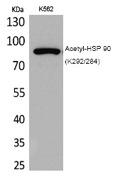 Anti-Acetyl-HSP90AA1 (Lys292, 284) Polyclonal Antibody