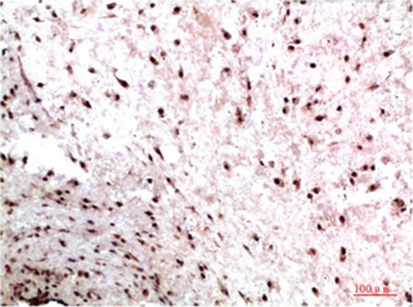Anti-CBX3 Antibody (1M6)