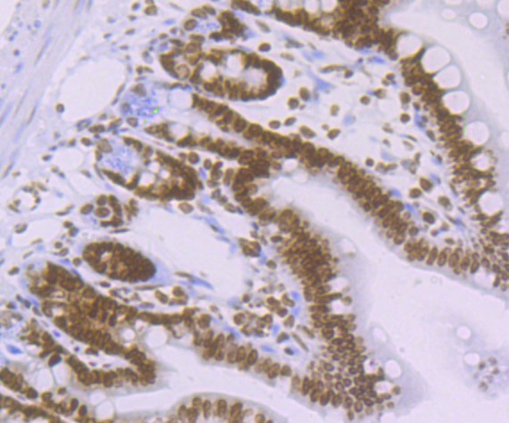 Anti-Acetyl-Histone H4 (Lys16) Antibody (5P883)