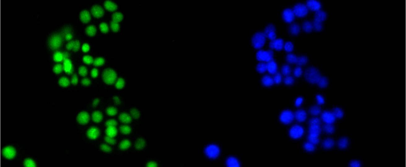 Anti-HMGB1 Antibody (5H227)