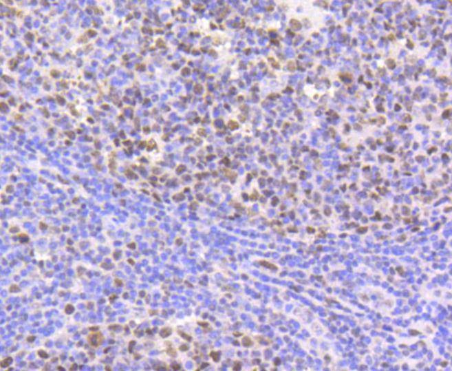 Anti-CBX5 Antibody (5G758)