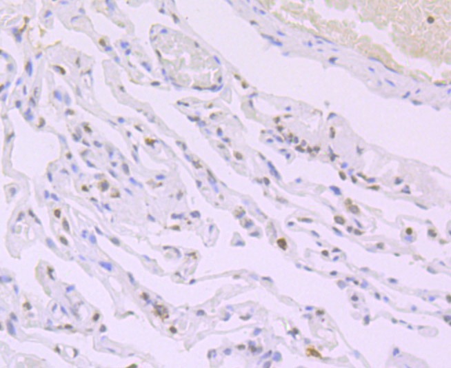 Anti-Acetyl-Histone H4 (Lys16) Antibody (5P883)