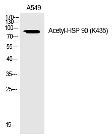 Anti-Acetyl-HSP90AA1 (Lys435) Polyclonal Antibody