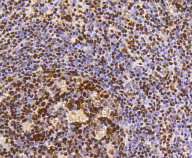 Anti-HMGB1 Antibody (5H227)