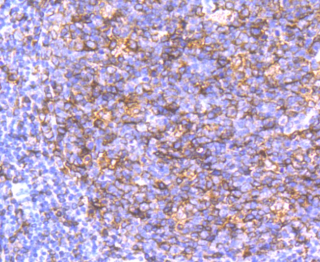 Anti-HLA-DQA1 Antibody (6J773)