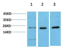 Anti-CBX5 Antibody (6Z70)